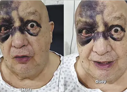 LUIS DE ALBA SUFRE ACCIDENTE