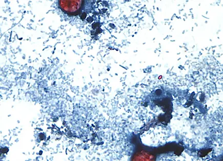 Michigan reporta brote de cyclospora con 992 casos y 40 hospitalizaciones