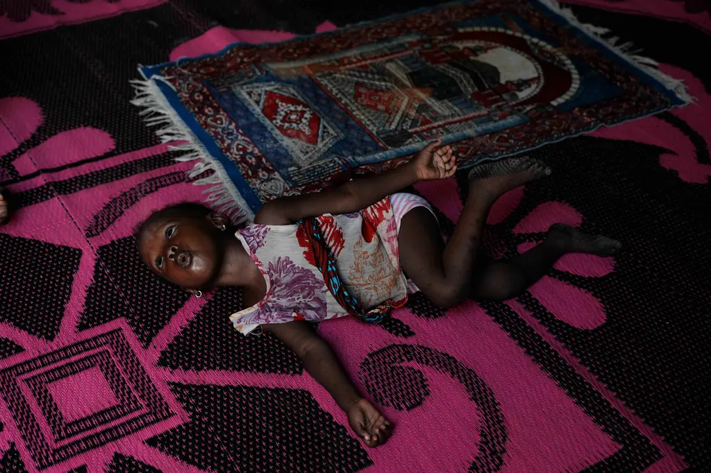 Niños nigerianos pagan el precio de la guerra en Irán: desnutrición aumenta