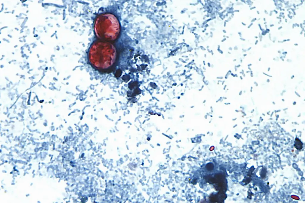 Autoridades de EEUU analizan brote de cyclospora con 72 casos
