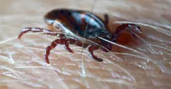 Confirman virus Bourbon, transmitida por garrapatas, en Nueva York