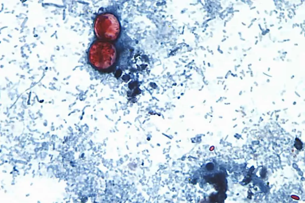 Michigan reporta dos muertes por brote de ciclosporiasis