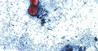 Michigan reporta dos muertes por brote de ciclosporiasis