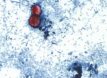 Michigan reporta dos muertes por brote de ciclosporiasis