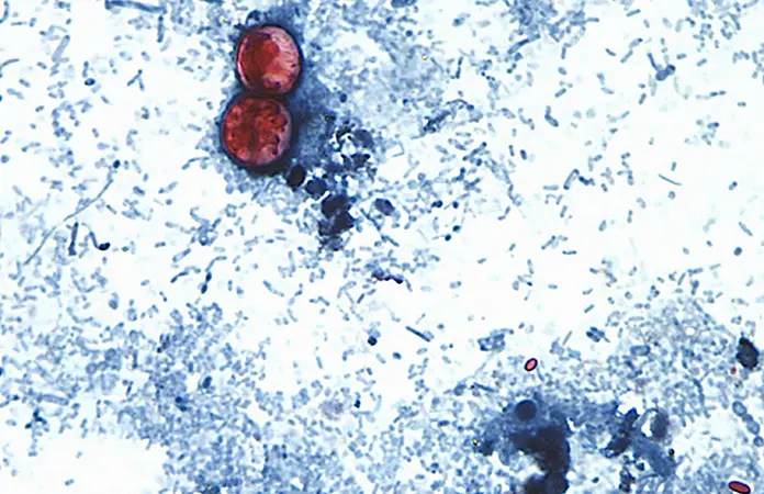 Reportan en EU primeras muertes por ciclosporiasis