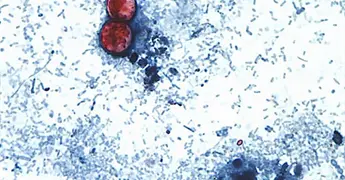 Reportan en EU primeras muertes por ciclosporiasis