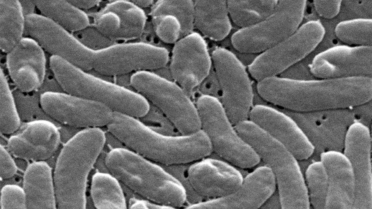 Autoridades de salud de EEUU alertan a bañistas de bacteria carnívora en aguas costeras