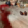 Agarran a machetazos a hombre en ri&ntilde;a
