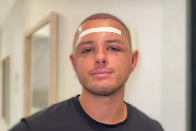 Javier Chicharito Hernández presume nuevo cabello en redes sociales