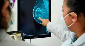 Estefan&iacute;a Meneses crea pr&oacute;tesis artesanales para c&aacute;ncer de mama