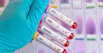 Aumentan casos  de s&iacute;filis y VIH