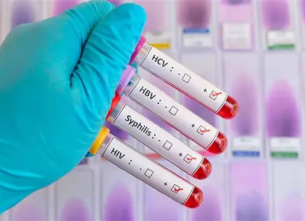 Aumentan casos  de s&iacute;filis y VIH